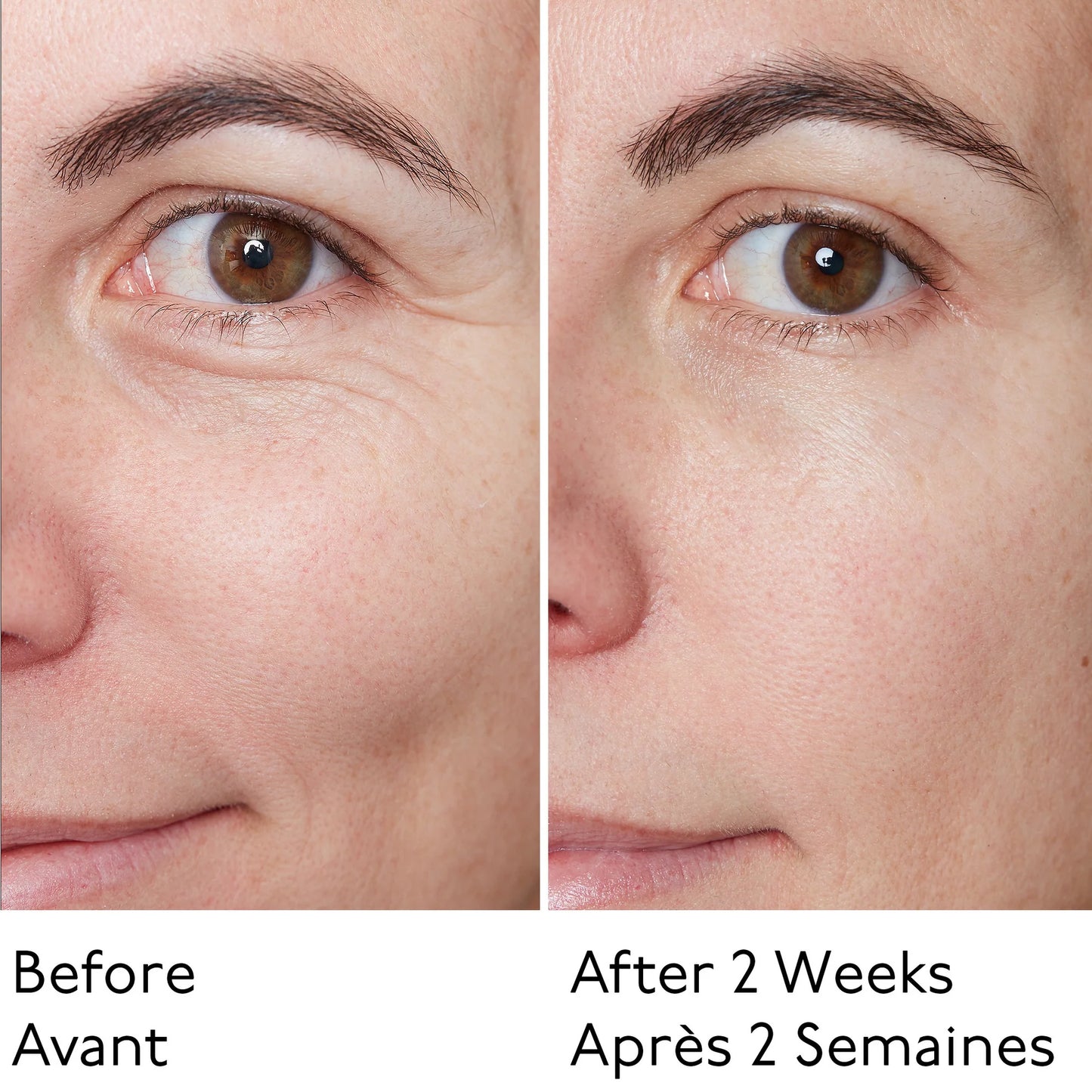 Hyaluronic Global Serum