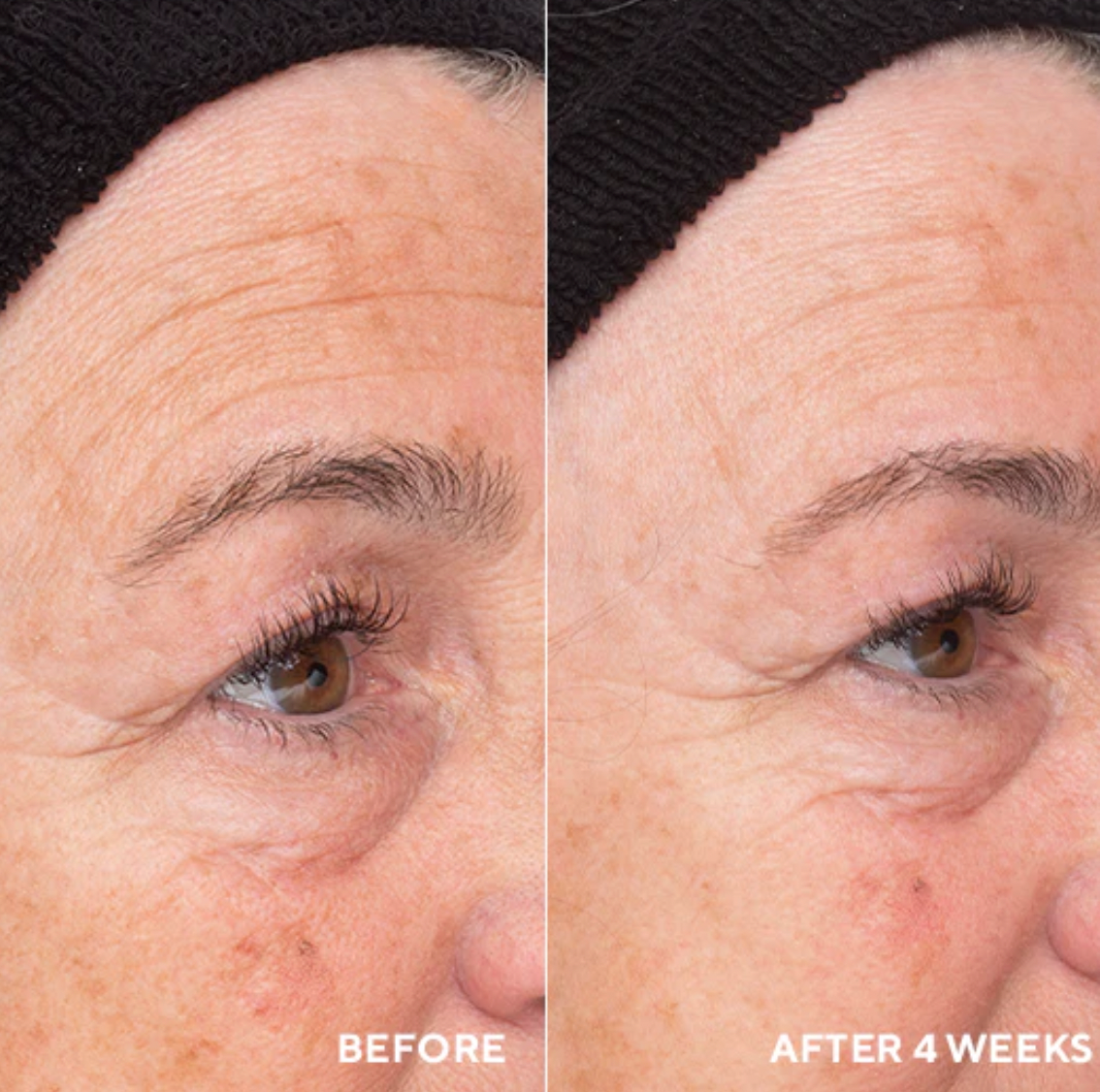 Liquid Resurfacing Solution