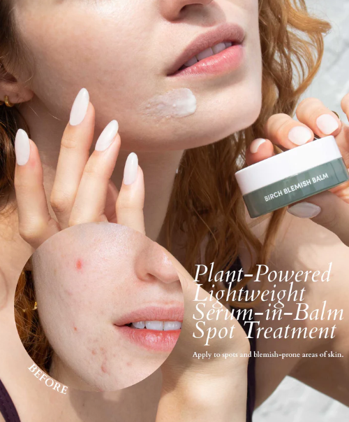 Birch Blemish Balm