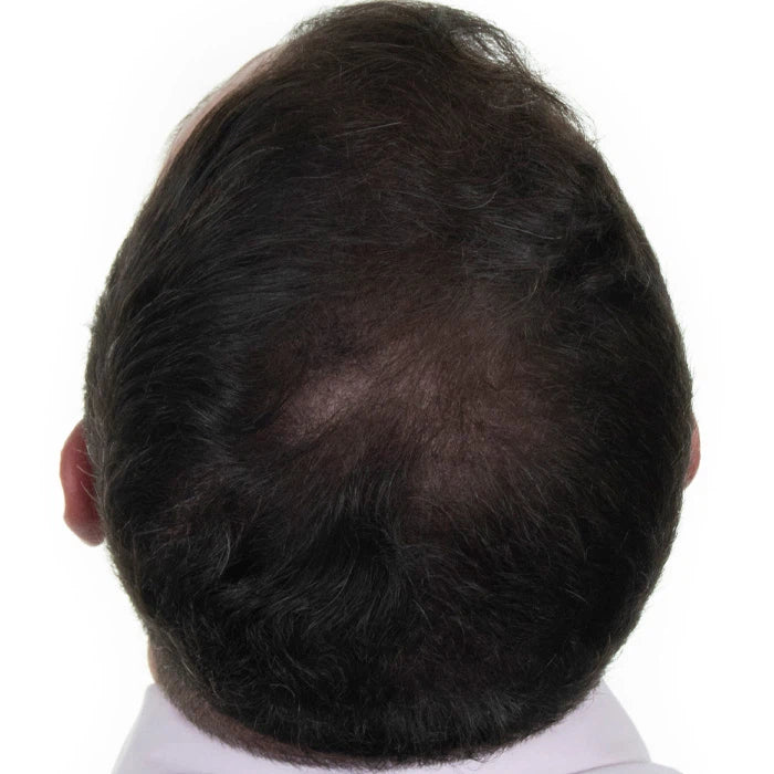 The Hair Revitalizing Complex