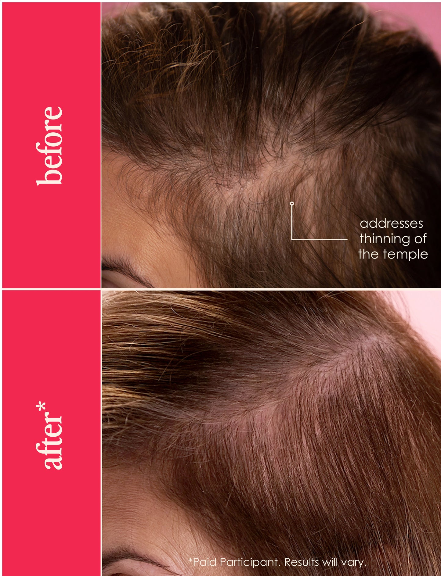 GrandeHAIR Hair Enhancing Serum
