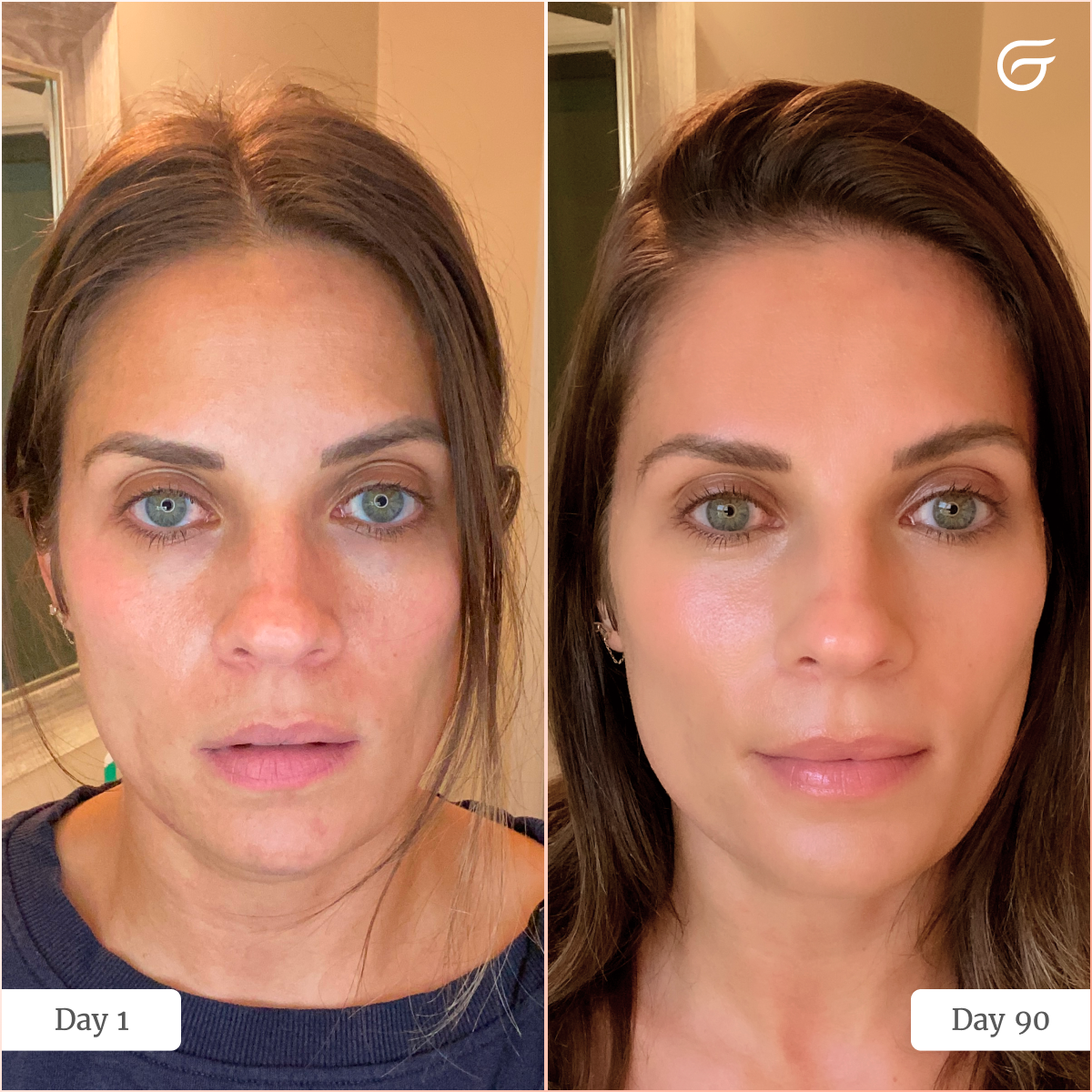 GlowUp™ LED Light Therapy Neck & Chest Mask